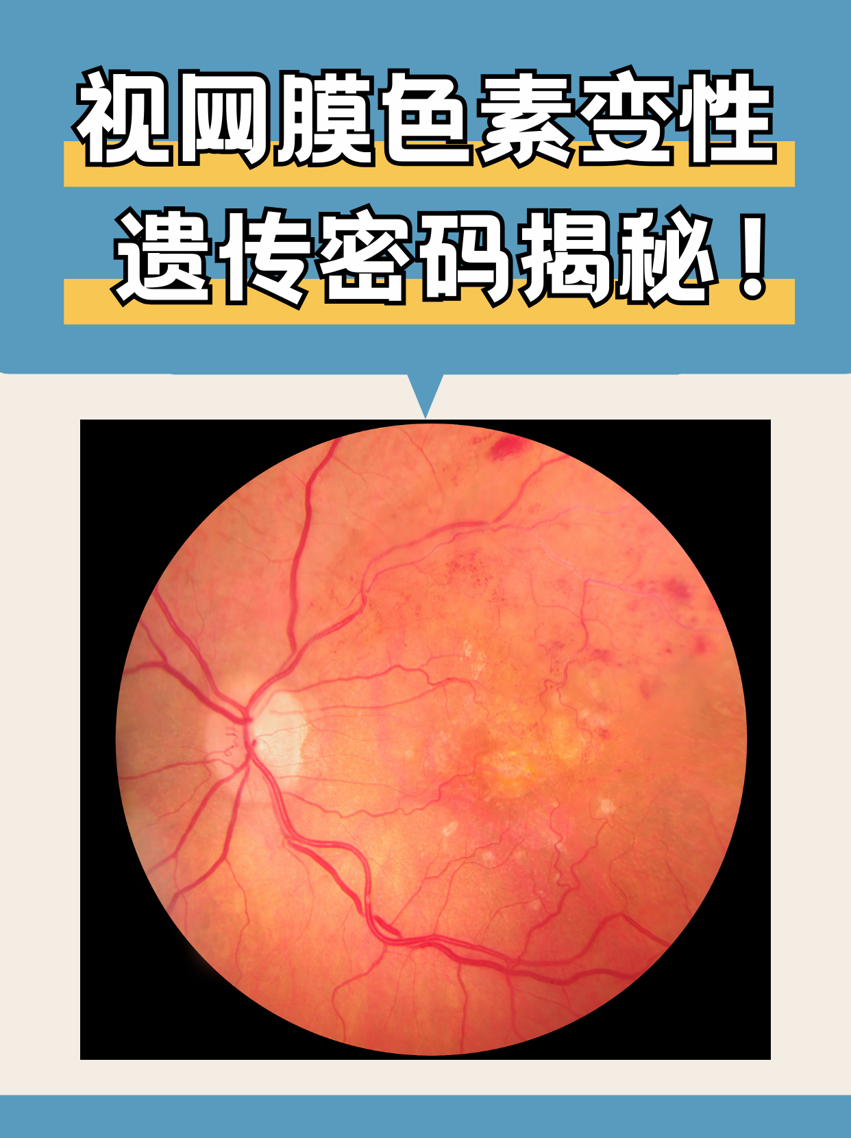 什么是Retina視網(wǎng)膜屏與retina顯示器的好處